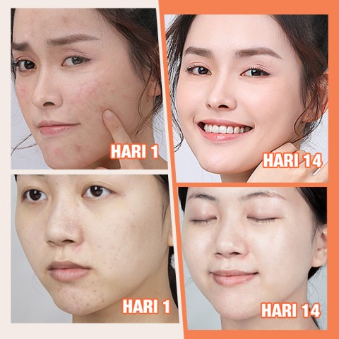 ELLEN ELLA Krim Wajah Pagi & Malam yang Ditingkatkan