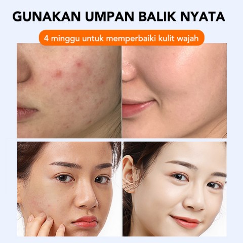 Triple Retinol Morning C Night Set Perawatan Kulit