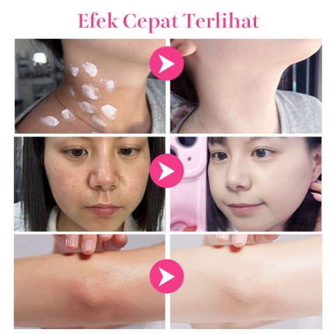 ELLEN ELLA Niacinamide Krim Pemutih Wajah dan Tubuh