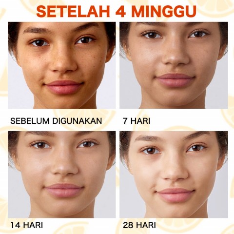 ELLEN ELLA Serum Wajah Vitamin C Pemutih 30ml