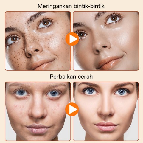 ELLEN ELLA Serum Wajah Vitamin C Pemutih 30ml