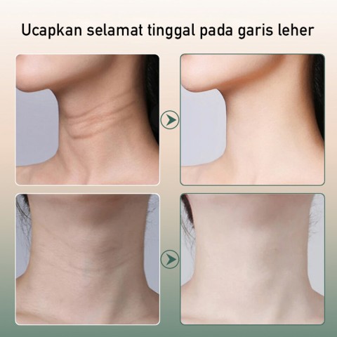 Alat kecantikan pijat yang mengangkat & mengencangkan kulit-Garansi-Produk tidak berlaku, pengembalian dana penuh