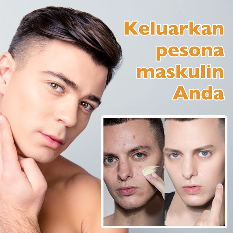BPOM - Upgrade Ellen Ella Retinol Anti aging Cream- Membantu mengungkapkan kulit yang tampak lebih halus dan lebih kencang dengan perawatan retinol yang lembut ini.