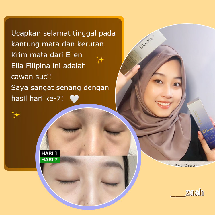Dapatkan 2 masker wajah sebagai hadiah -ELLEN ELLA Krim Mata Pagi & Malam - Menghilangkan Lingkaran Hitam, Kantong Mata, Kerutan dalam 7 Hari - Dikirim dari gudang Jakartas