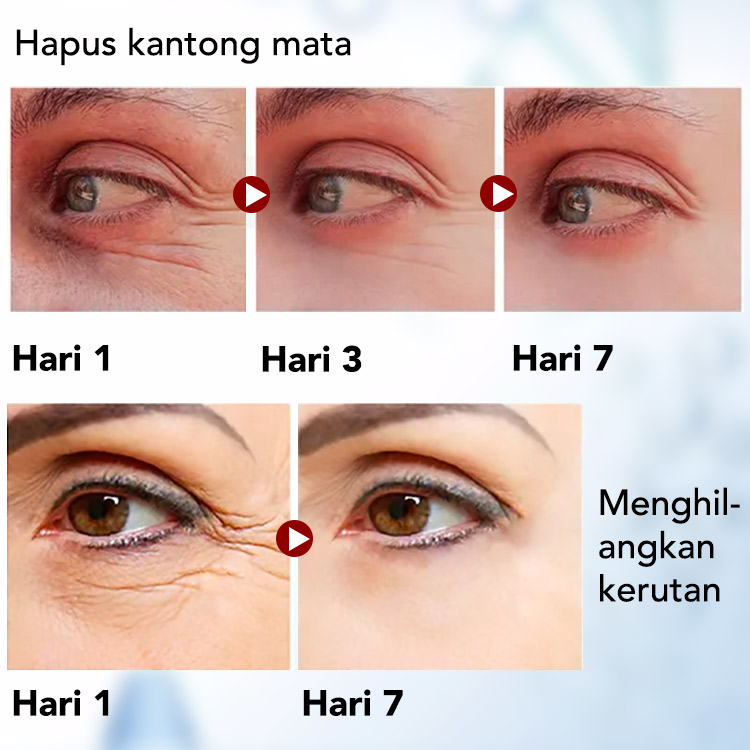 ELLEN ELLA Deep Sea Caviar Eye Cream 20g - Menghilangkan kantung mata, lingkaran hitam, kerutan