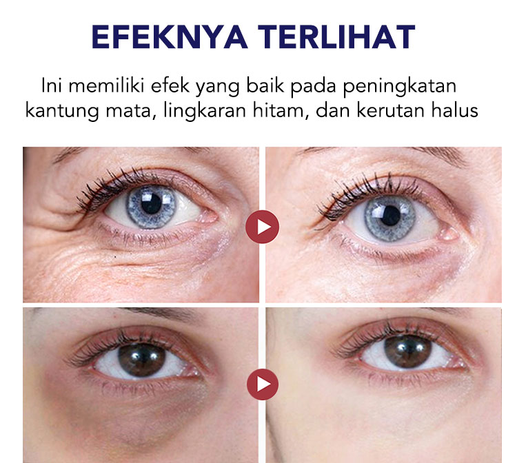  ELLEN ELLA Deep Sea Caviar Eye Cream 20g - Menghilangkan kantung mata, lingkaran hitam, kerutan