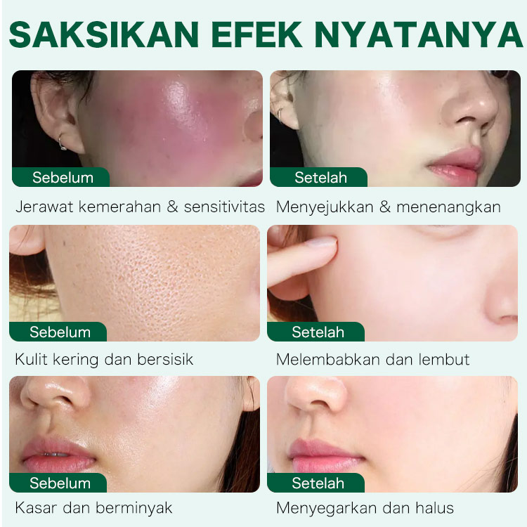 Krim Gel Penenang Ellen Ella Cica-ReBalance 50g