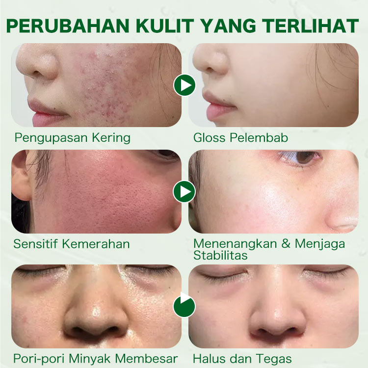 BPOM -Ellen Ella Cica-ReBalance Sleeping Mask dan Perangkat kecantikan tingkat lanjut-Whitening mengecilkan pori-pori - Dapatkan pijat gratis sebagai hadiah