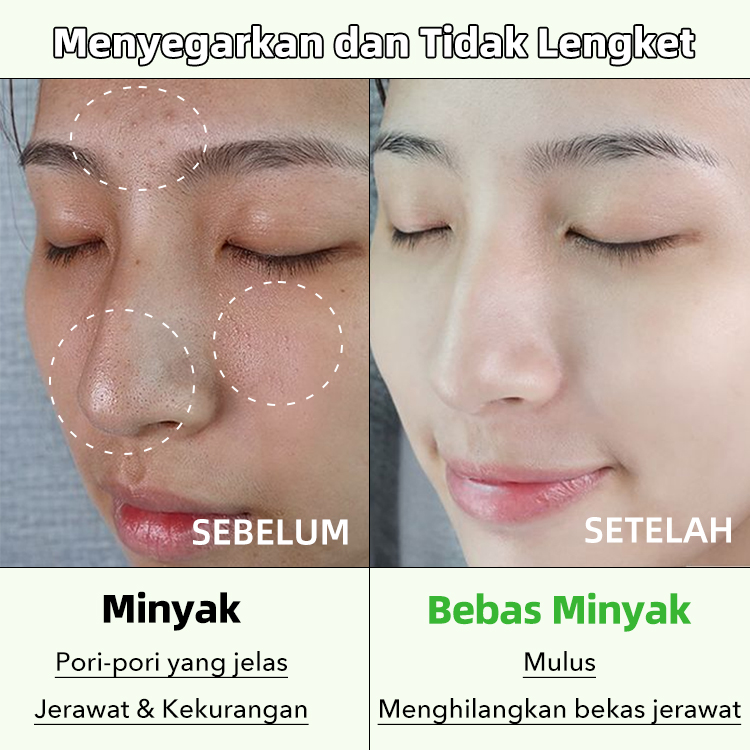 Ellen Ella Centella Asiatica Skin Savior Combo-clean&oil control,shrinkpores,smooth&delicate,mengencangkan kulit - Cocok untuk 15-65+ - ramah untuk semua jenis kulit