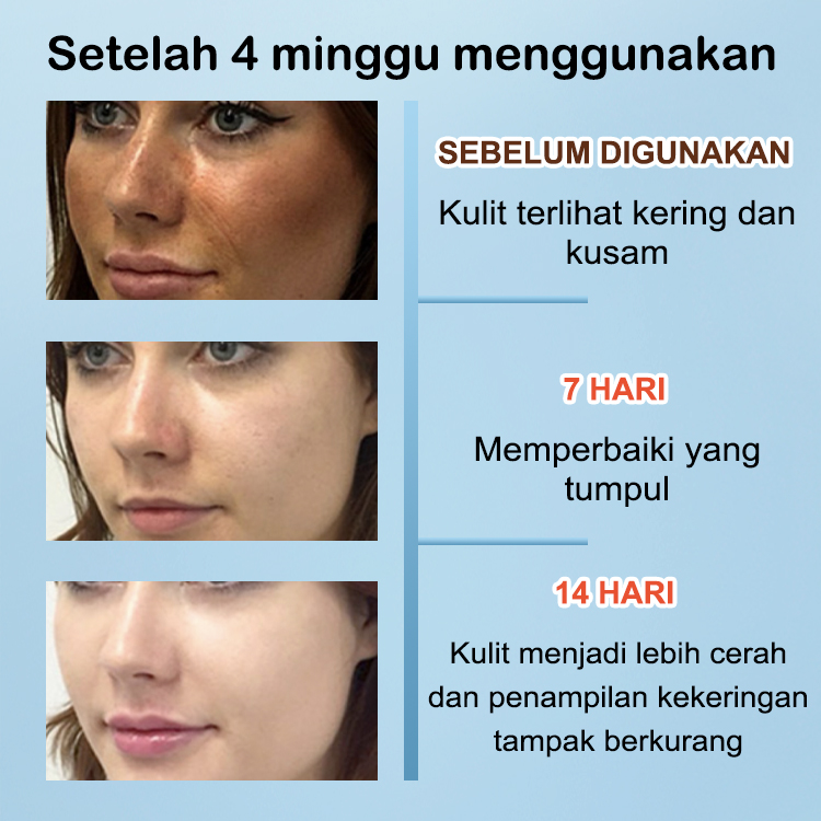 Rangkaian Perawatan Kulit Lanjutan ELLEN ELLA - Super Pagi Pemutih & Lanjut Malam Anti-penuaan - Serum Kompleks Emas VC & Krim Triple Retinol & Tabir Surya SPF90+