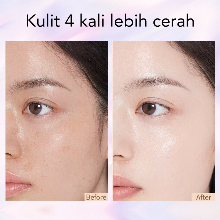 Ellen Ella Radiant Niacinamide Serum Cream-Mengandung 75% esensi mawar, efek pemutihannya 8 kali lipat dari krim biasa