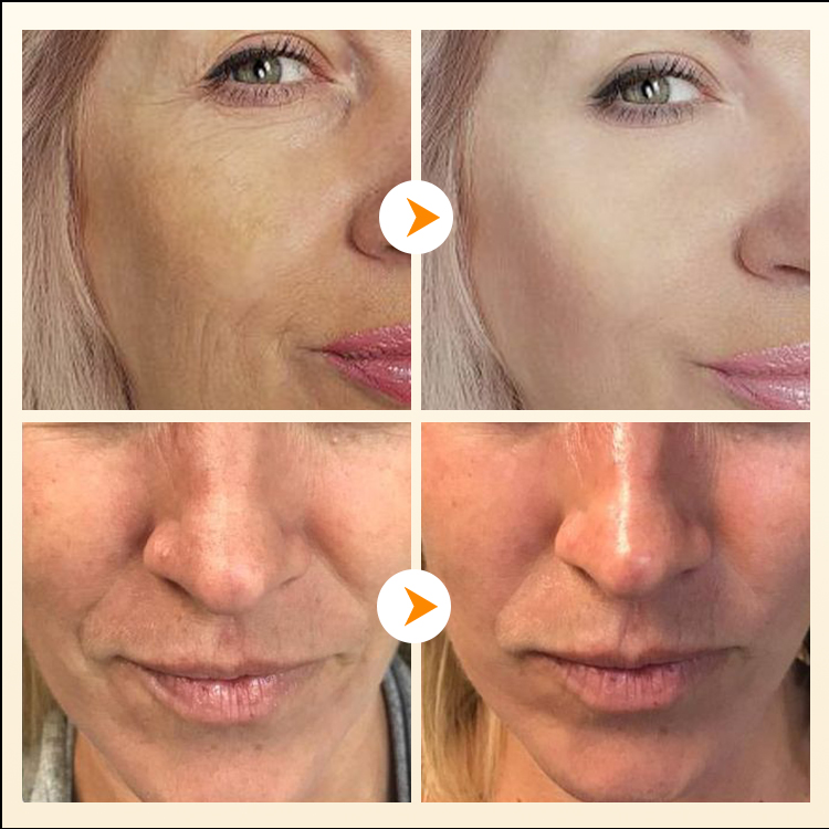 Beli 1 gratis 1 - Efek Krim Wajah Retinol 3X meningkat 50% - Mengurangi kerutan dan mengencangkan kulit -10 tahun lebih muda