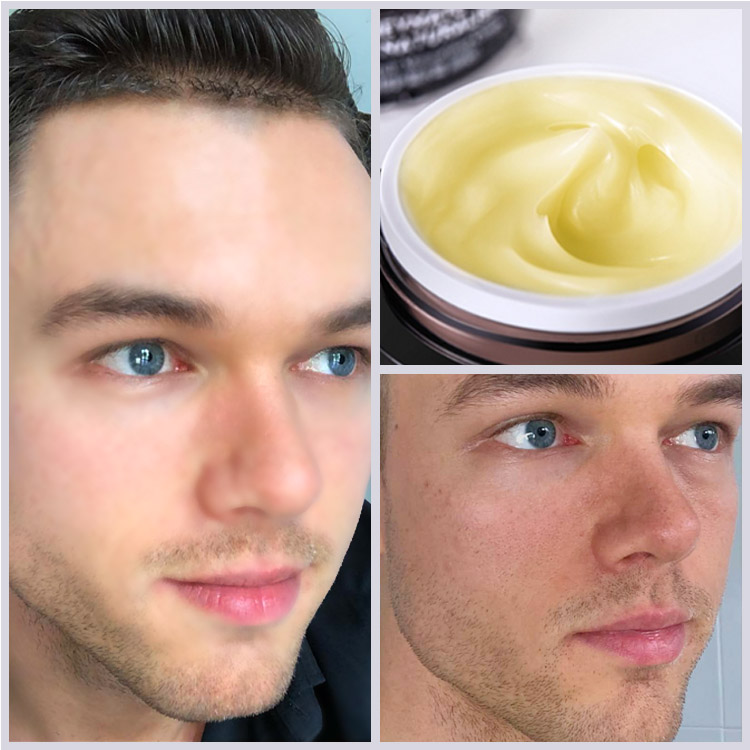 BPOM - Upgrade Ellen Ella Retinol Face Cream- Beli 1 Dapat 1 - Efek meningkat sebesar 50% - Membantu mengungkapkan kulit yang tampak lebih halus dan lebih kencang dengan perawatan retinol yang lembut ini.