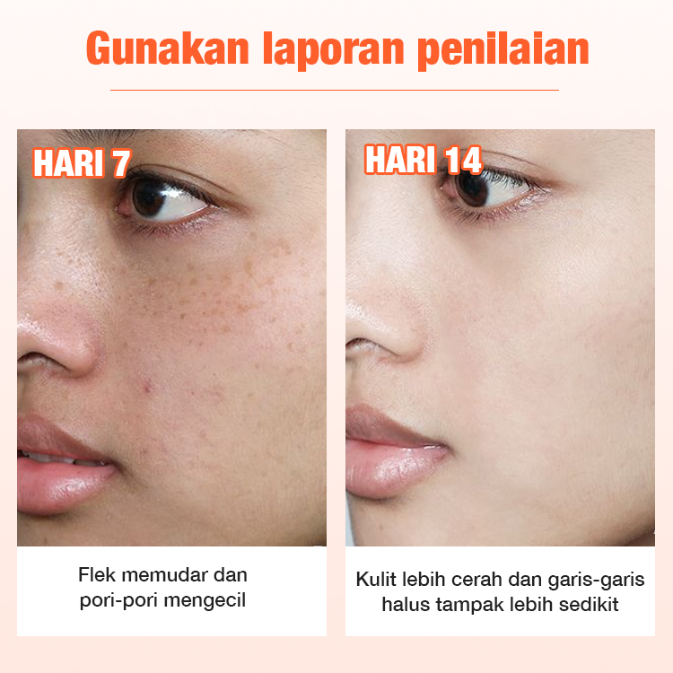 ELLEN ELLA Tingkatkan Krim Wajah Pemutih Vitamin C 30g