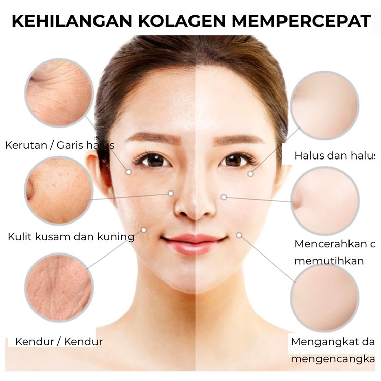 Kesepakatan Super Ramadhan-VA Retinol Krim anti penuaan dan krim pemutih VC