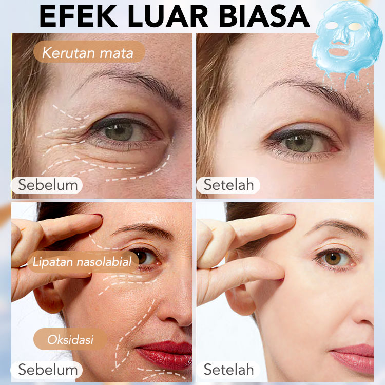 ELLEN ELLA Triple Retinol Niacinamide Anti Aging Whitening Masker Wajah - Meringankan kerutan, memecah melanin - Tiba dalam 1-4 hari