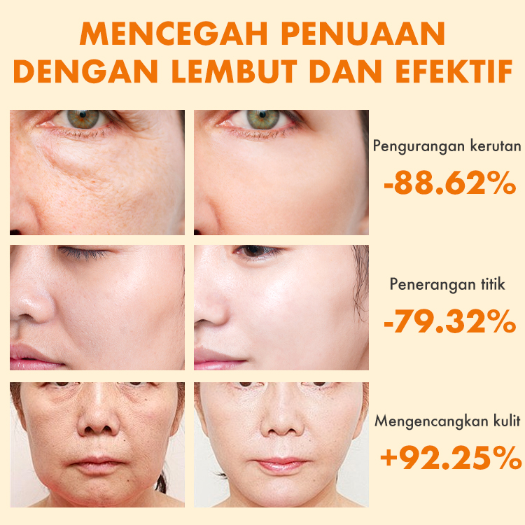 Ellen Ella Serum Retinol yang Ditingkatkan